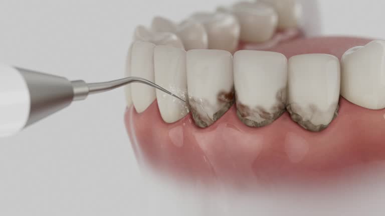 Reliable Dental contractor in Enigma, GA by Smile Center Dentistry